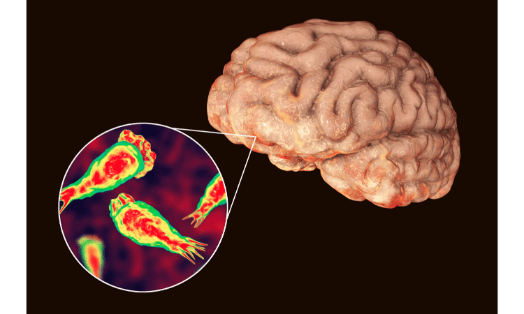 Know About Brain Eating Amoeba
