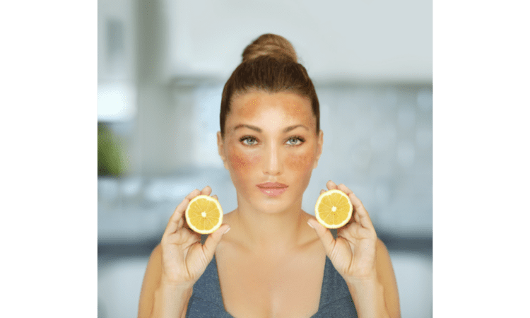 Foods To eat to Reverse Hyperpigmentation