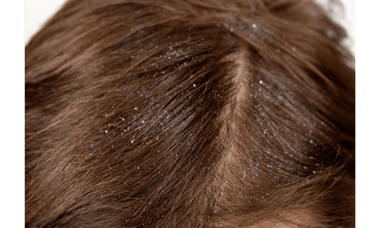 Benefits of Papaya for hair
